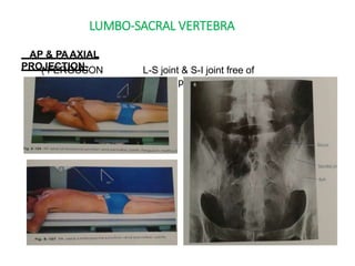 LUMBO-SACRAL VERTEBRA
AP & PAAXIAL
PROJECTION-
( FERGUSON
METHOD)-
L-S joint & S-I joint free of
superimposition.
 