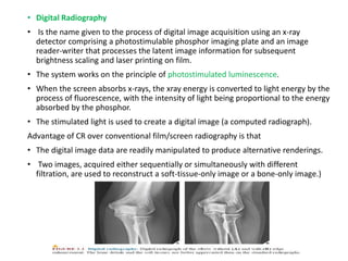 • Digital Radiography
• Is the name given to the process of digital image acquisition using an x-ray
detector comprising a photostimulable phosphor imaging plate and an image
reader-writer that processes the latent image information for subsequent
brightness scaling and laser printing on film.
• The system works on the principle of photostimulated luminescence.
• When the screen absorbs x-rays, the xray energy is converted to light energy by the
process of fluorescence, with the intensity of light being proportional to the energy
absorbed by the phosphor.
• The stimulated light is used to create a digital image (a computed radiograph).
Advantage of CR over conventional film/screen radiography is that
• The digital image data are readily manipulated to produce alternative renderings.
• Two images, acquired either sequentially or simultaneously with different
filtration, are used to reconstruct a soft-tissue-only image or a bone-only image.)
 