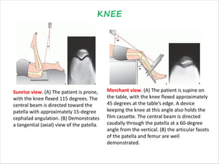 radiologyinorthopaedics-211220135331(1).pdf