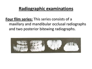 Radiographic examinations

Four film series: This series consists of a
  maxillary and mandibular occlusal radiographs
  and two posterior bitewing radiographs.
 