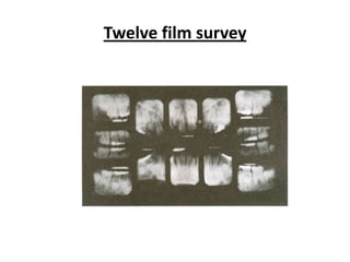 Twelve film survey
 