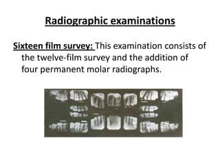 Radiographic examinations

Sixteen film survey: This examination consists of
  the twelve-film survey and the addition of
  four permanent molar radiographs.
 
