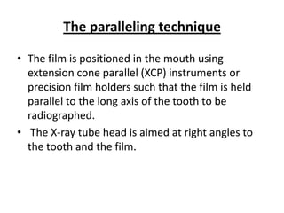 The paralleling technique

• The film is positioned in the mouth using
  extension cone parallel (XCP) instruments or
  precision film holders such that the film is held
  parallel to the long axis of the tooth to be
  radiographed.
• The X-ray tube head is aimed at right angles to
  the tooth and the film.
 
