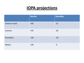 IOPA projections
                  Maxilla       Mandible


Anterior teeth    +40           -15


Canines           +45           -20


Premolars         +30           -10


Molars            +20           -5
 