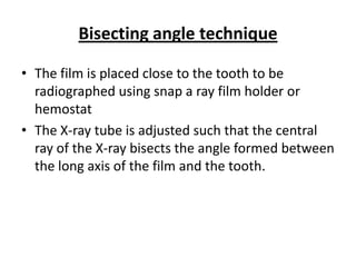 Bisecting angle technique

• The film is placed close to the tooth to be
  radiographed using snap a ray film holder or
  hemostat
• The X-ray tube is adjusted such that the central
  ray of the X-ray bisects the angle formed between
  the long axis of the film and the tooth.
 