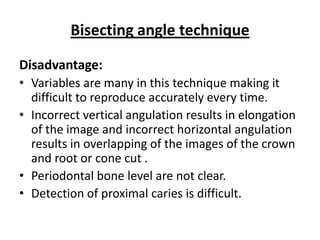 Bisecting angle technique

Disadvantage:
• Variables are many in this technique making it
  difficult to reproduce accurately every time.
• Incorrect vertical angulation results in elongation
  of the image and incorrect horizontal angulation
  results in overlapping of the images of the crown
  and root or cone cut .
• Periodontal bone level are not clear.
• Detection of proximal caries is difficult.
 