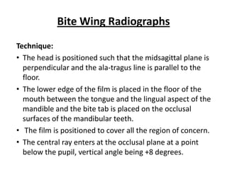 Bite Wing Radiographs
Technique:
• The head is positioned such that the midsagittal plane is
  perpendicular and the ala-tragus line is parallel to the
  floor.
• The lower edge of the film is placed in the floor of the
  mouth between the tongue and the lingual aspect of the
  mandible and the bite tab is placed on the occlusal
  surfaces of the mandibular teeth.
• The film is positioned to cover all the region of concern.
• The central ray enters at the occlusal plane at a point
  below the pupil, vertical angle being +8 degrees.
 