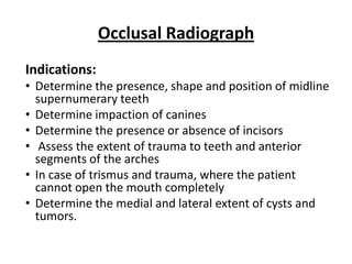 Occlusal Radiograph
Indications:
• Determine the presence, shape and position of midline
  supernumerary teeth
• Determine impaction of canines
• Determine the presence or absence of incisors
• Assess the extent of trauma to teeth and anterior
  segments of the arches
• In case of trismus and trauma, where the patient
  cannot open the mouth completely
• Determine the medial and lateral extent of cysts and
  tumors.
 