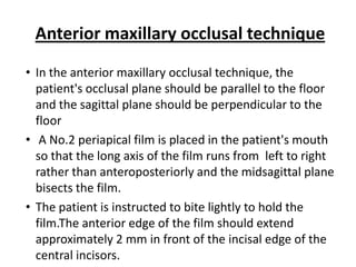 Anterior maxillary occlusal technique
• In the anterior maxillary occlusal technique, the
  patient's occlusal plane should be parallel to the floor
  and the sagittal plane should be perpendicular to the
  floor
• A No.2 periapical film is placed in the patient's mouth
  so that the long axis of the film runs from left to right
  rather than anteroposteriorly and the midsagittal plane
  bisects the film.
• The patient is instructed to bite lightly to hold the
  film.The anterior edge of the film should extend
  approximately 2 mm in front of the incisal edge of the
  central incisors.
 