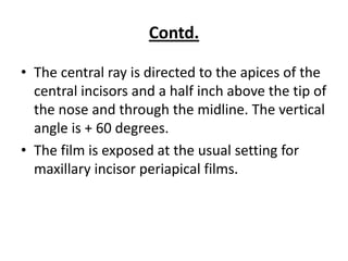 Contd.

• The central ray is directed to the apices of the
  central incisors and a half inch above the tip of
  the nose and through the midline. The vertical
  angle is + 60 degrees.
• The film is exposed at the usual setting for
  maxillary incisor periapical films.
 