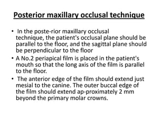 Posterior maxillary occlusal technique
• In the poste-rior maxillary occlusal
  technique, the patient's occlusal plane should be
  parallel to the floor, and the sagittal plane should
  be perpendicular to the floor
• A No.2 periapical film is placed in the patient's
  mouth so that the long axis of the film is parallel
  to the floor.
• The anterior edge of the film should extend just
  mesial to the canine. The outer buccal edge of
  the film should extend ap-proximately 2 mm
  beyond the primary molar crowns.
 