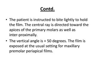 Contd.
• The patient is instructed to bite lightly to hold
  the film. The central ray is directed toward the
  apices of the primary molars as well as
  inter-proximally.
• The vertical angle is + 50 degrees. The film is
  exposed at the usual setting for maxillary
  premolar periapical films.
 