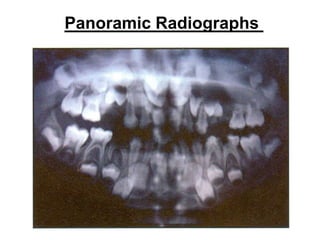 Panoramic Radiographs
 