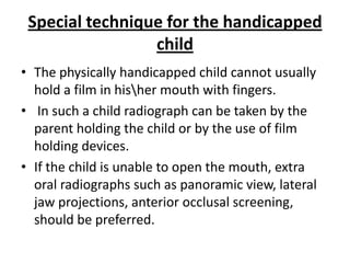 Special technique for the handicapped
                 child
• The physically handicapped child cannot usually
  hold a film in hisher mouth with fingers.
• In such a child radiograph can be taken by the
  parent holding the child or by the use of film
  holding devices.
• If the child is unable to open the mouth, extra
  oral radiographs such as panoramic view, lateral
  jaw projections, anterior occlusal screening,
  should be preferred.
 