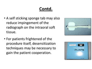 Contd.
• A self sticking sponge tab may also
  reduce impingement of the
  radiograph on the intraoral soft
  tissue.
• For patients frightened of the
  procedure itself, desensitization
  techniques may be necessary to
  gain the patient cooperation.
 