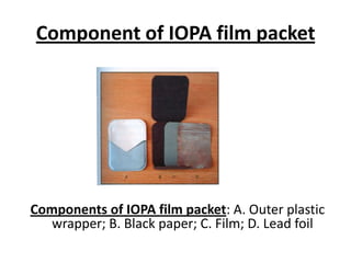Component of IOPA film packet




Components of IOPA film packet: A. Outer plastic
   wrapper; B. Black paper; C. Film; D. Lead foil
 