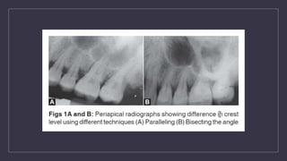 Periodontal Radiographs Radiological techniques in periodontics.pptx