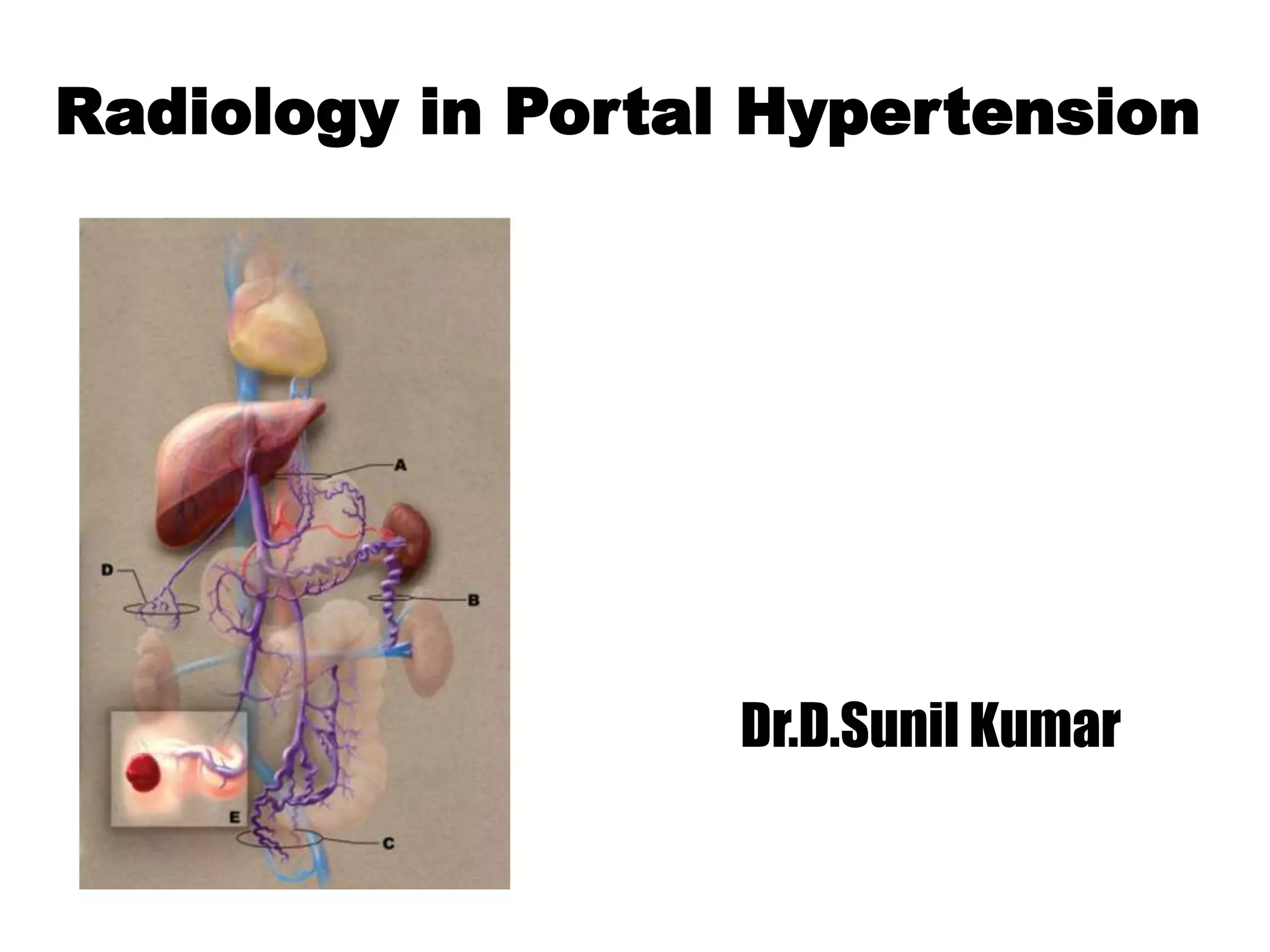 Radiology in portal hypertension | PPTX