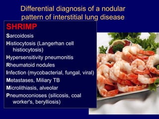 Differential diagnosis of a nodular
pattern of interstitial lung disease
SHRIMP
Sarcoidosis
Histiocytosis (Langerhan cell
histiocytosis)
Hypersensitivity pneumonitis
Rheumatoid nodules
Infection (mycobacterial, fungal, viral)
Metastases, Miliary TB
Microlithiasis, alveolar
Pneumoconioses (silicosis, coal
worker's, berylliosis)
 