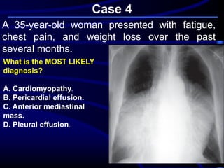 Case 4
A 35-year-old woman presented with fatigue,
chest pain, and weight loss over the past
several months.
What is the MOST LIKELY
diagnosis?
A. Cardiomyopathy.
B. Pericardial effusion.
C. Anterior mediastinal
mass.
D. Pleural effusion.
 