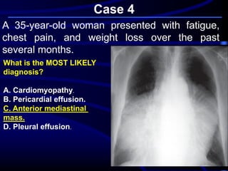 Case 4
A 35-year-old woman presented with fatigue,
chest pain, and weight loss over the past
several months.
What is the MOST LIKELY
diagnosis?
A. Cardiomyopathy.
B. Pericardial effusion.
mediastinalC. Anterior
mass.
D. Pleural effusion.
 