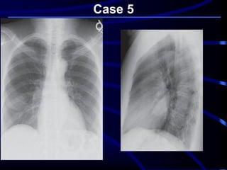 Case 5
 
