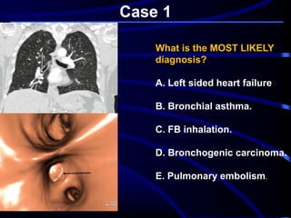 Case 1
What is the MOST LIKELY
diagnosis?
A. Left sided heart failure
B. Bronchial asthma.
C. FB inhalation.
D. Bronchogenic carcinoma.
E. Pulmonary embolism.
 
