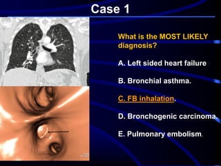 Case 1
What is the MOST LIKELY
diagnosis?
A. Left sided heart failure
B. Bronchial asthma.
.FB inhalation.C
D. Bronchogenic carcinoma.
E. Pulmonary embolism.
 