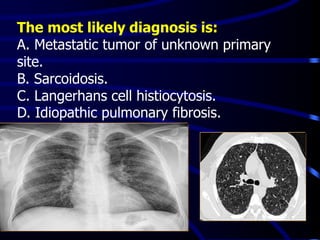 The most likely diagnosis is:
A. Metastatic tumor of unknown primary
site.
B. Sarcoidosis.
C. Langerhans cell histiocytosis.
D. Idiopathic pulmonary fibrosis.
 