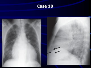 Case 10
 