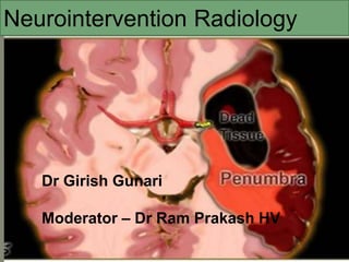 Dr Girish Gunari
Moderator – Dr Ram Prakash HV
Neurointervention Radiology
 