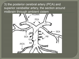 Pca Inervates Radiology intervetion neuro | PPTX