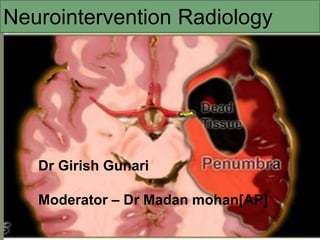 Dr Girish Gunari
Moderator – Dr Madan mohan[AP]
Neurointervention Radiology
 