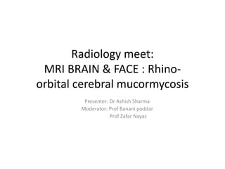 Radiology meet:
MRI BRAIN & FACE : Rhino-
orbital cerebral mucormycosis
Presenter: Dr Ashish Sharma
Moderator: Prof Banani poddar
Prof Zafar Nayaz
 