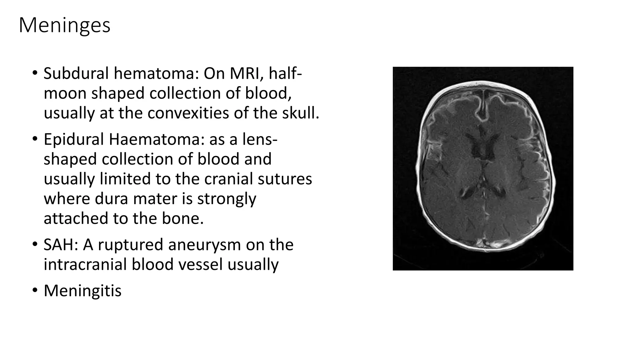 radiology ppt on mri sequences how to read basic mri sequences and ...