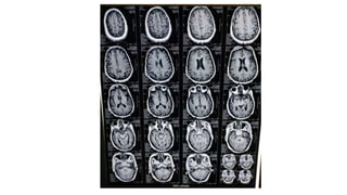 radiology ppt on mri sequences how to read basic mri sequences and ...