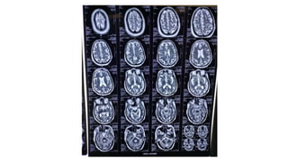 radiology ppt on mri sequences how to read basic mri sequences and ...