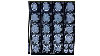 radiology ppt on mri sequences how to read basic mri sequences and ...