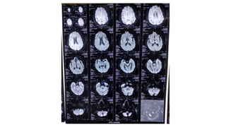 radiology ppt on mri sequences how to read basic mri sequences and ...