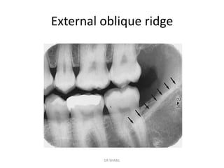 Oblique Ridge Radiography radiology normal.pdf. dentistry. Oral. Medicine and radiology | PDF