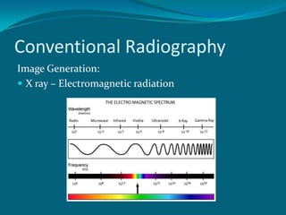 Conventional Radiography
Image Generation:
 X ray – Electromagnetic radiation
 