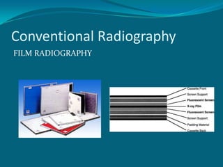 Conventional Radiography
FILM RADIOGRAPHY
 