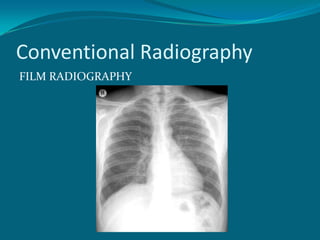 Conventional Radiography
FILM RADIOGRAPHY
 