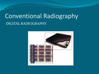 Conventional Radiography
DIGITAL RADIOGRAPHY
 