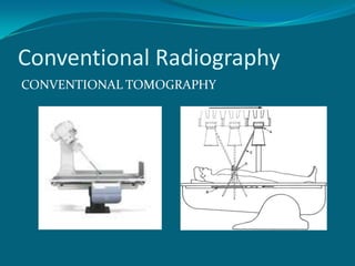 Conventional Radiography
CONVENTIONAL TOMOGRAPHY
 