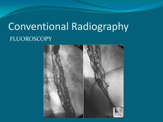 Conventional Radiography
FLUOROSCOPY
 