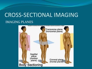 CROSS-SECTIONAL IMAGING
IMAGING PLANES
 