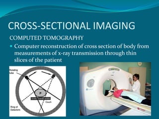 CROSS-SECTIONAL IMAGING
COMPUTED TOMOGRAPHY
 Computer reconstruction of cross section of body from
  measurements of x-ray transmission through thin
  slices of the patient
 