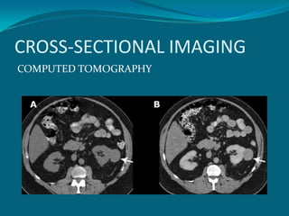 CROSS-SECTIONAL IMAGING
COMPUTED TOMOGRAPHY
 