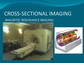 CROSS-SECTIONAL IMAGING
MAGNETIC RESONANCE IMAGING
 
